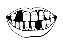 Mund mit Zähnen